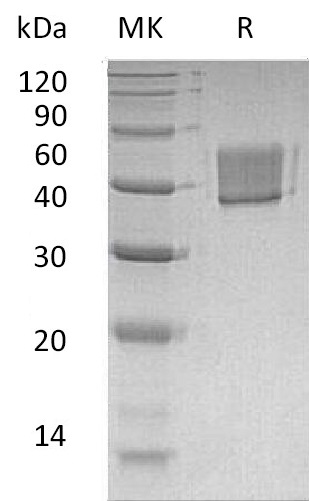 Human FcRL1 +SDS-PAGE.jpg